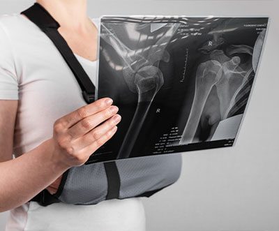 Shoulder Pain After an Auto Accident in Fort Worth