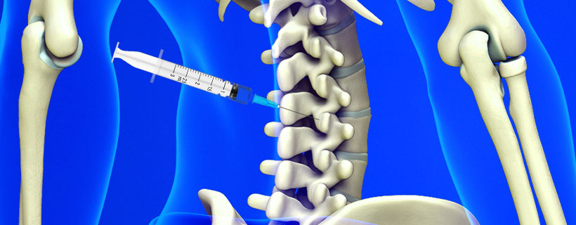 patient receiving Facet Joint Injections in Fort Worth for auto accident injury pain relief