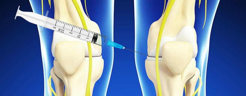 patient receiving HYALGAN Injections in Fort Worth for auto accident injury pain relief