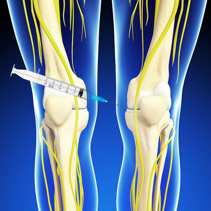 hyalgan knee injections in Fort Worth