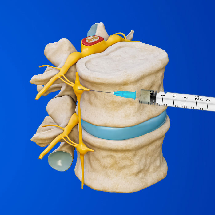 lumbar sympathetic block in Fort Worth