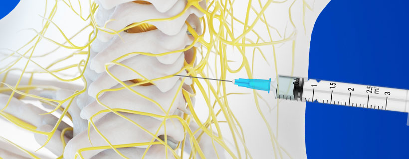 patient receiving Medial Branch Block in Fort Worth for auto accident injury pain relief