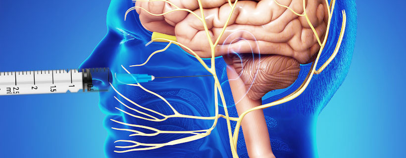 patient receiving Sphenopalatine Ganglion Block in Fort Worth for auto accident injury pain relief