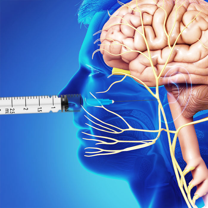 sphenopalatine ganglion block in Fort Worth