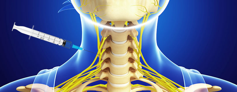 patient receiving Stellate Ganglion Block in Fort Worth for auto accident injury pain relief