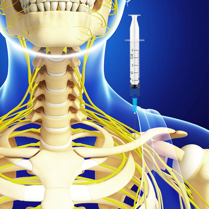 suprascapular nerve block in Fort Worth